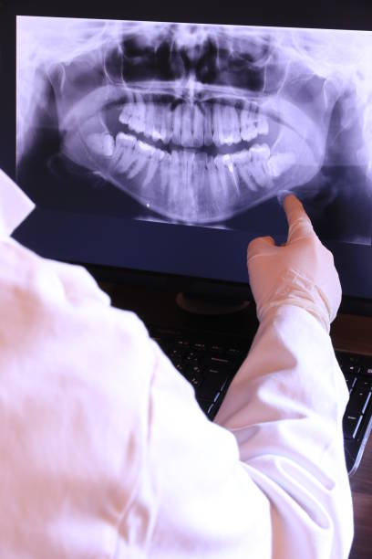 Best Emergency Denture Repair in New Richmond, WI
