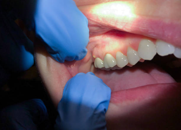 Best Cosmetic Emergency Dentistry in New Richmond, WI