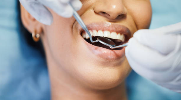 Best Emergency Gum Treatment in New Richmond, WI