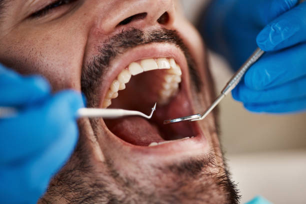 Best Cosmetic Emergency Dentistry in New Richmond, WI