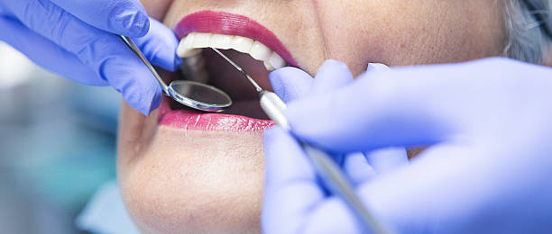 Best Emergency Dental Care for Broken or Chipped Teeth in New Richmond, WI